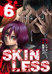 SKINLESS（６）