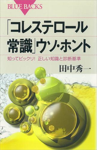 「コレステロール常識」ウソ・ホント　知ってビックリ！　正しい知識と診断基準